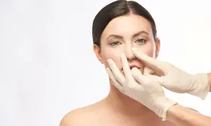 Septoplasty