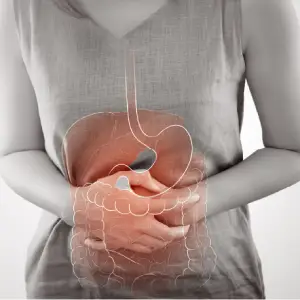 Inflammatory Bowel Disease (IBD)