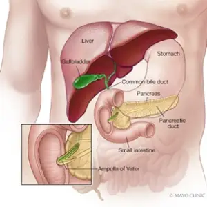 Pancreatitis