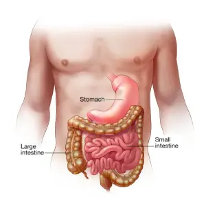 Gastroenteritis