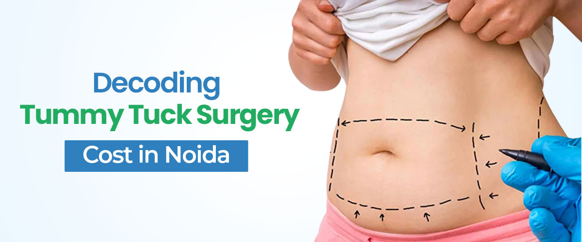 Best Tummy Tuck Before and After -100% Safe & Secure Surgery