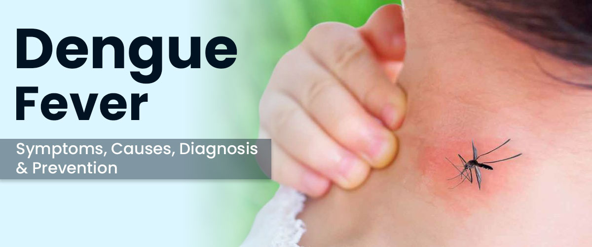 Dengue Fever Symptoms Causes Diagnosis Prevention