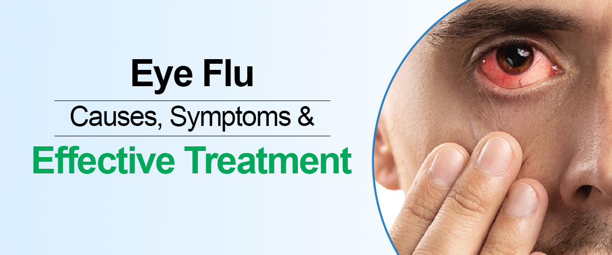 https://www.felixhospital.com/sites/default/files/2023-07/eye-flu-causes-symptoms-and-effective-treatment.jpg
