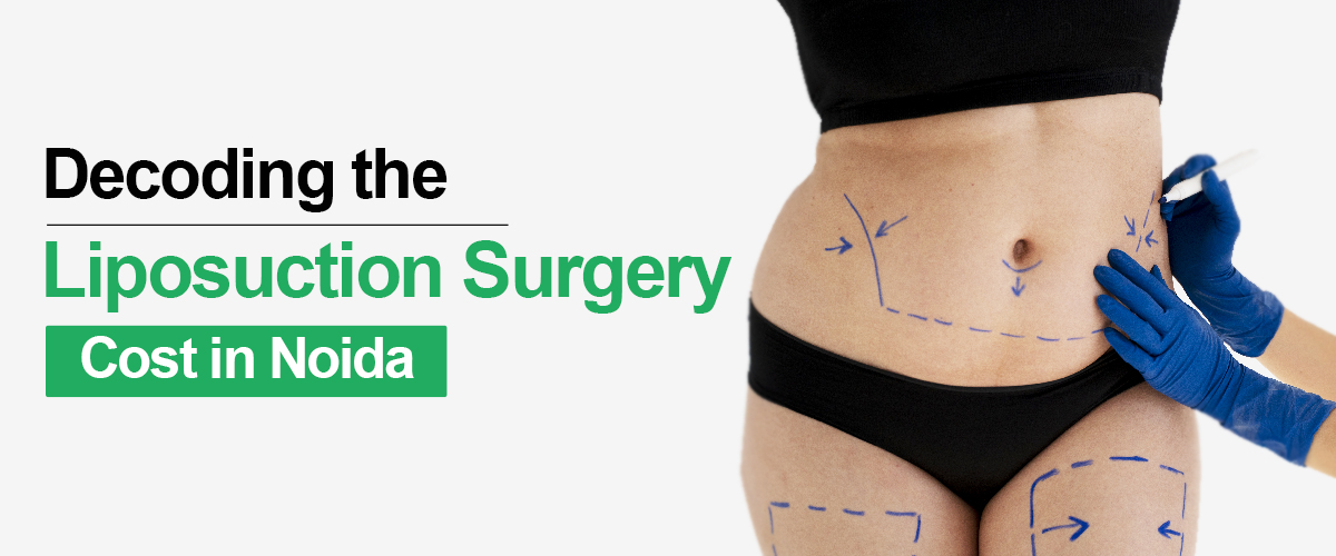 The Procedure For An Outpatient Liposuction Procedure Is