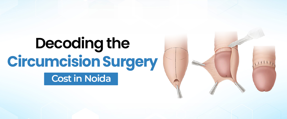 Decoding Circumcision Surgery Cost in Noida