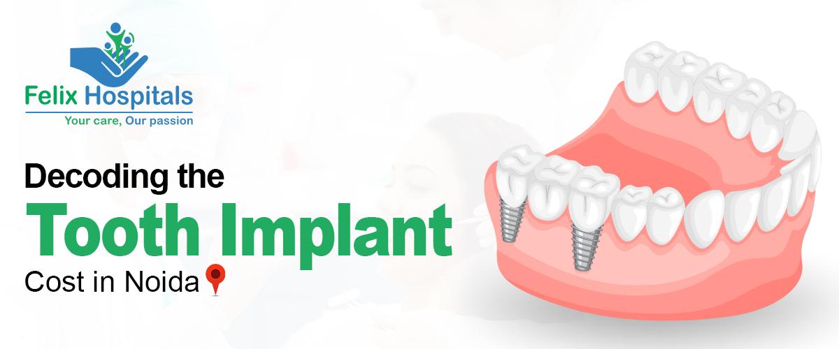Decoding the Tooth Implant Cost in Noida