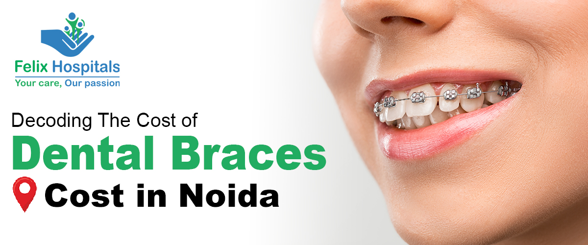 Decoding the Dental Braces Cost in Noida