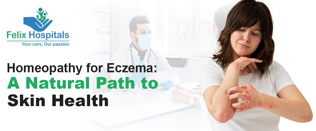 Homeopathy for Eczema: A Natural Path to Skin Health