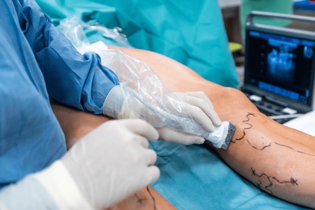 Vascular Surgery Hospital In Noida