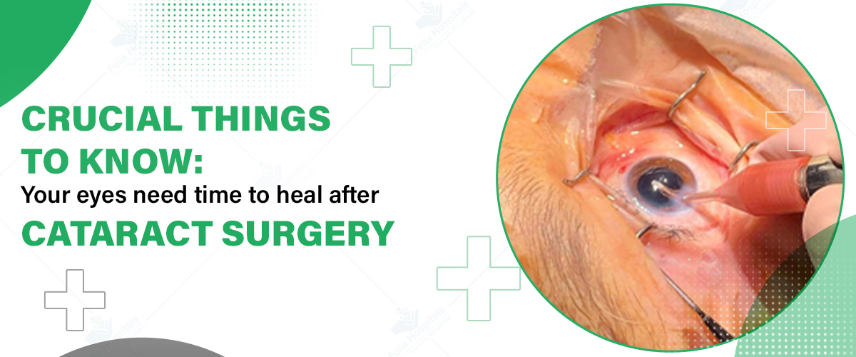 Why Do My Eyes Itch So Much After Cataract Surgery Infoupdate