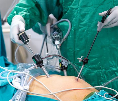 General, Minimal Access & Laparoscopic Surgery in Greater Noida