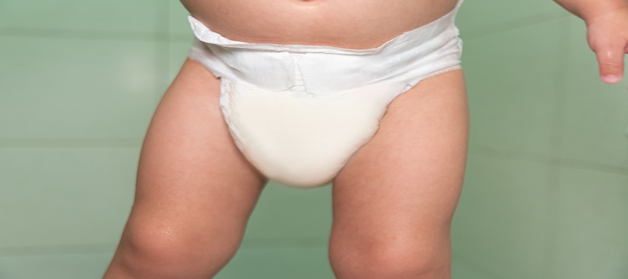 Operative Treatment in Noida for Childhood Hip Dysplasia