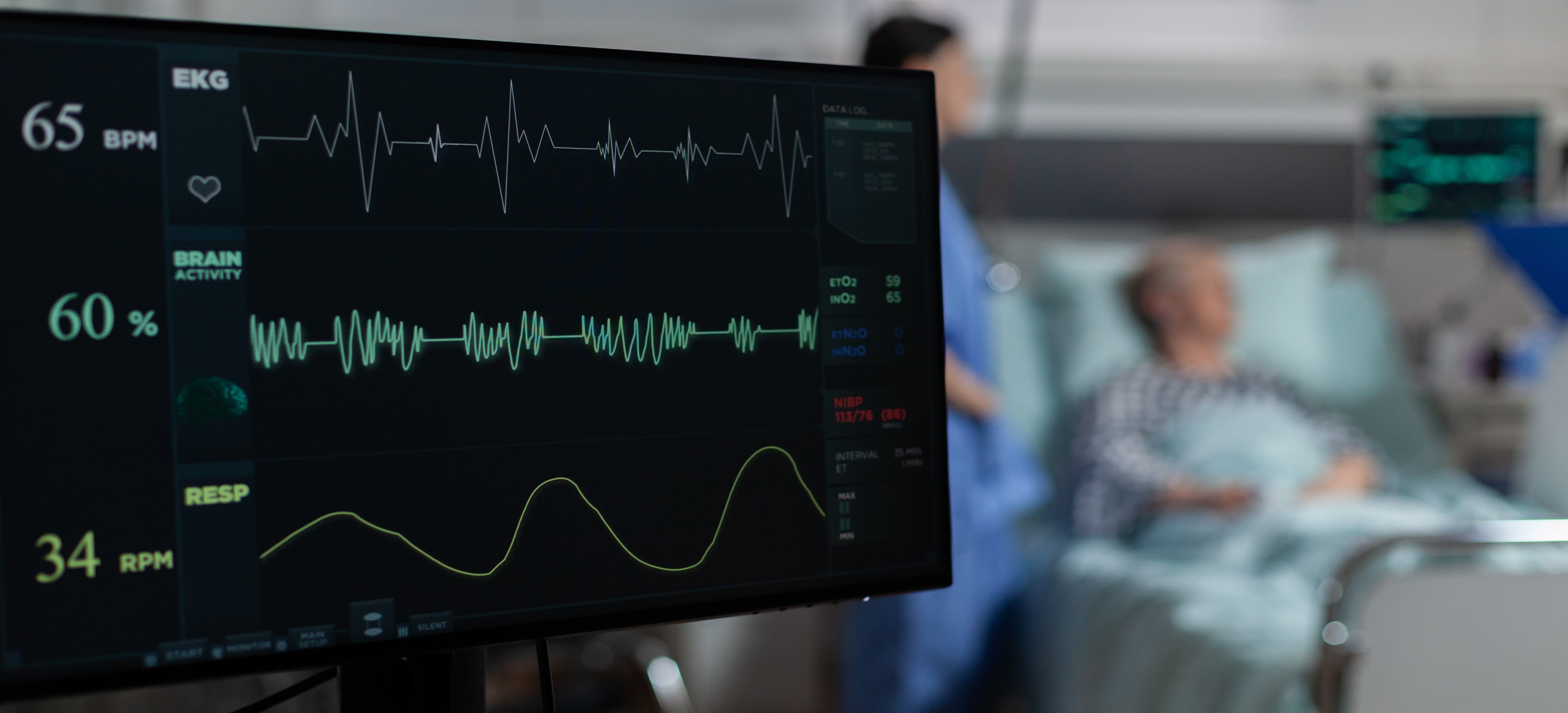 Echocardiogram