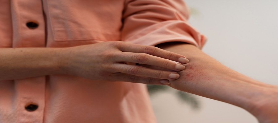 Fungal Infections After Surgery