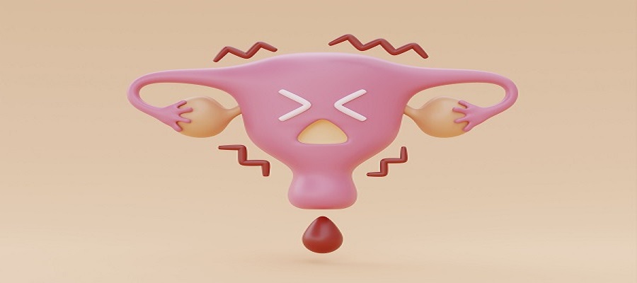 vaginal infection
