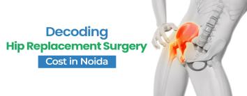Hip Replacement Surgery Cost in Noida