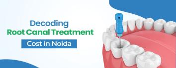 Root Canal Treatment Cost in Noida