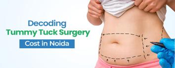 Tummy Tuck Surgery Cost in Noida