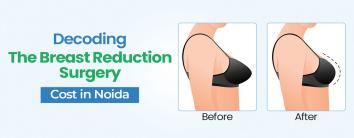 Breast Reduction Surgery Cost in Noida