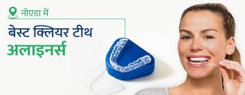 Clear aligners in hindi