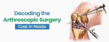 Arthroscopic Surgery Cost In Noida