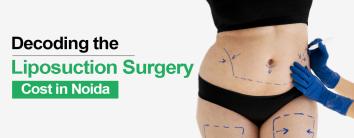 Liposuction Surgery Cost in Noida
