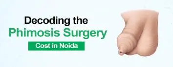 Phimosis Surgery Cost in Noida