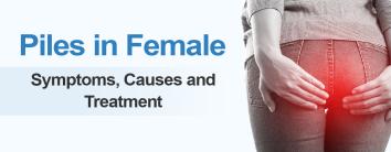 Symptoms of Piles in Female