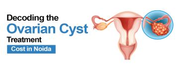 Ovarian Cyst Treatment Cost in Noida