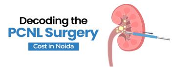 PCNL Surgery Cost in Noida