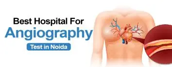 Best Hospital for angiography test in Noida