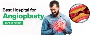 Best Hospital for Angioplasty test in Noida