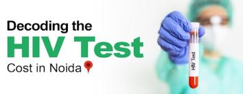 HIV Test Cost in Noida