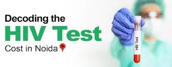 HIV Test Cost in Noida