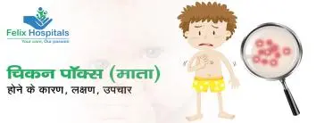 चिकन पॉक्स (माता) होने के कारण, लक्षण और उपचार