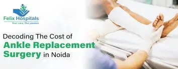 Ankle Replacement surgery cost