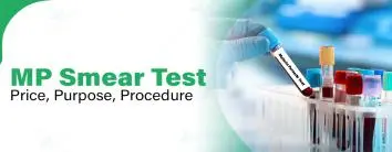MP Smear Test