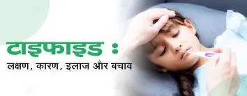 टाइफाइड (Typhoid in Hindi) : लक्षण, कारण, इलाज और बचाव