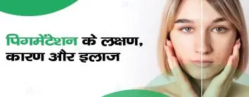 Pigmentation in Hindi Meaning
