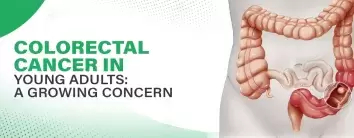 colorectal-cancer