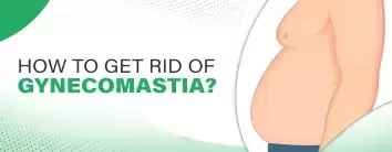 gynecomastia