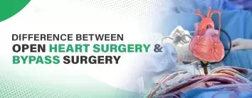 Difference Between Open Heart Surgery and Bypass Surgery
