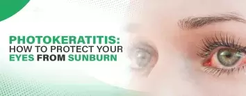 Photokeratitis: Protecting Your Eyes from Sunburn