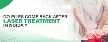 Do Piles Come Back After Laser Treatment?