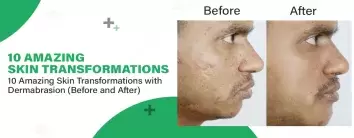 Amazing Skin Transformations