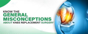 Know the General Misconceptions about Knee Replacement Surgery
