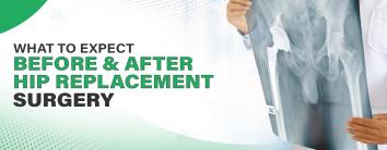 Looking for the best hip replacement surgery in Noida