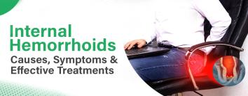 Internal Hemorrhoids
