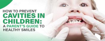 How to Prevent Cavities in Children: A Parent’s Guide to Healthy Smiles
