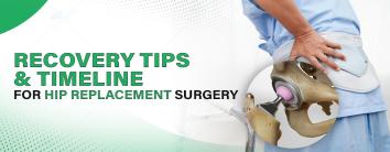 Recovery Tips and Timeline for Hip Replacement Surgery